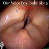 58597 - Unmoderated Can't Be Unseen - What Has Been Seen Can't Be Unseen Pictures - 49